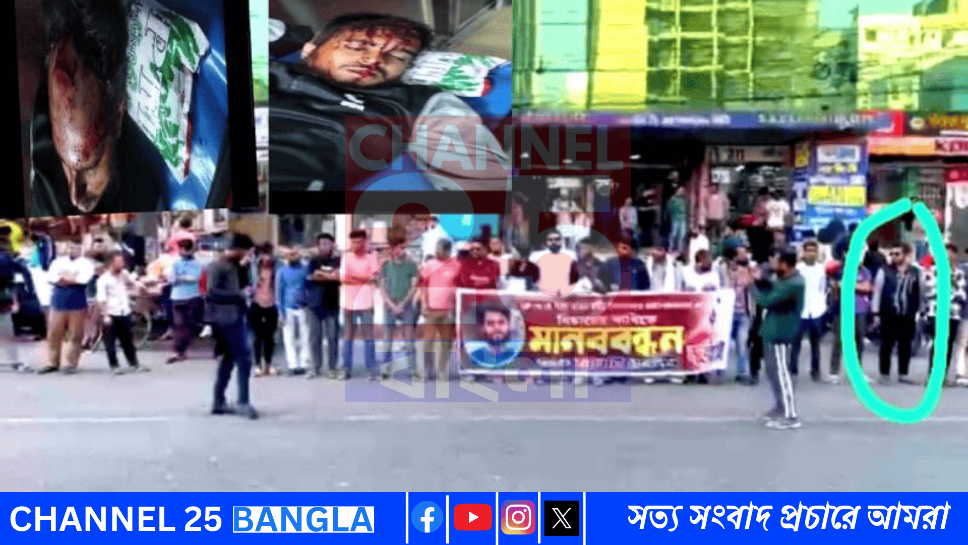 ওসমান হাদীর ওপর গুলির প্রতিবাদের মানববন্ধন শেষে উত্তরাে কুপিয়ে জখম দুই সদস্য